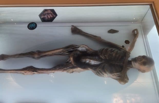 Buz Adam Ötzi, Yüksek Riskli Bir HPV Türü Taşıyordu