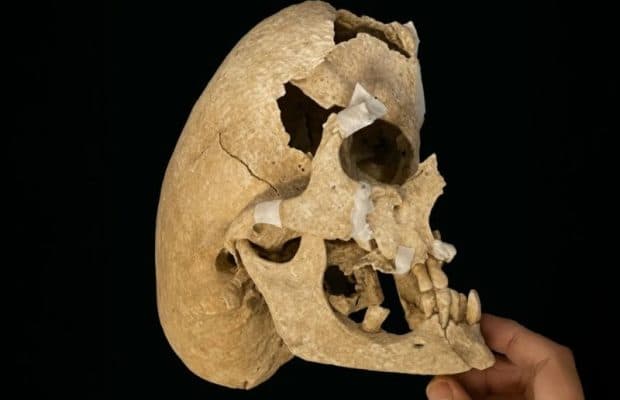 600 Yıllık Şövalyede Nadir Crouzon Sendromu Teşhis Edildi