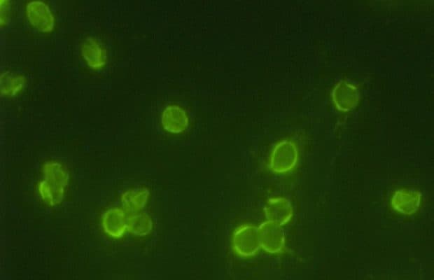 Roma Tuvalet Kabında, Amerika Kökenli Sanılan Parazit Bulundu