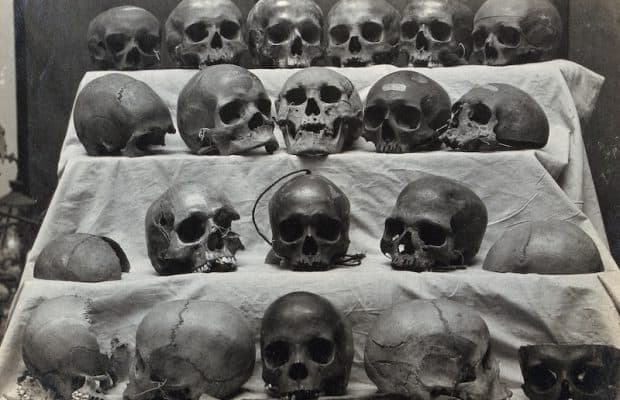 Son 100 Yılda İnsan Kafatasının Şekli Önemli Ölçüde Değişmiş