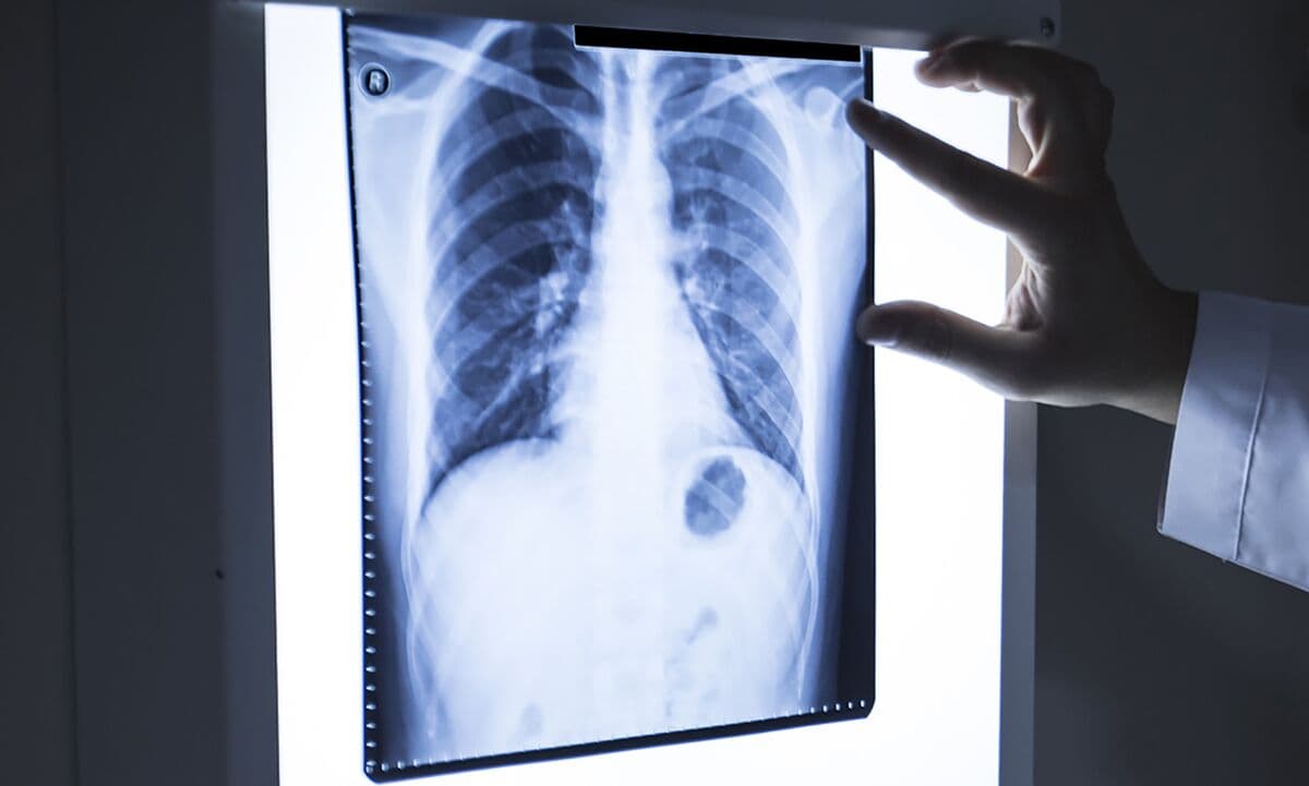 Novo-Backed Drugmaker Avalyn Raises $300 Million in Upsized IPO