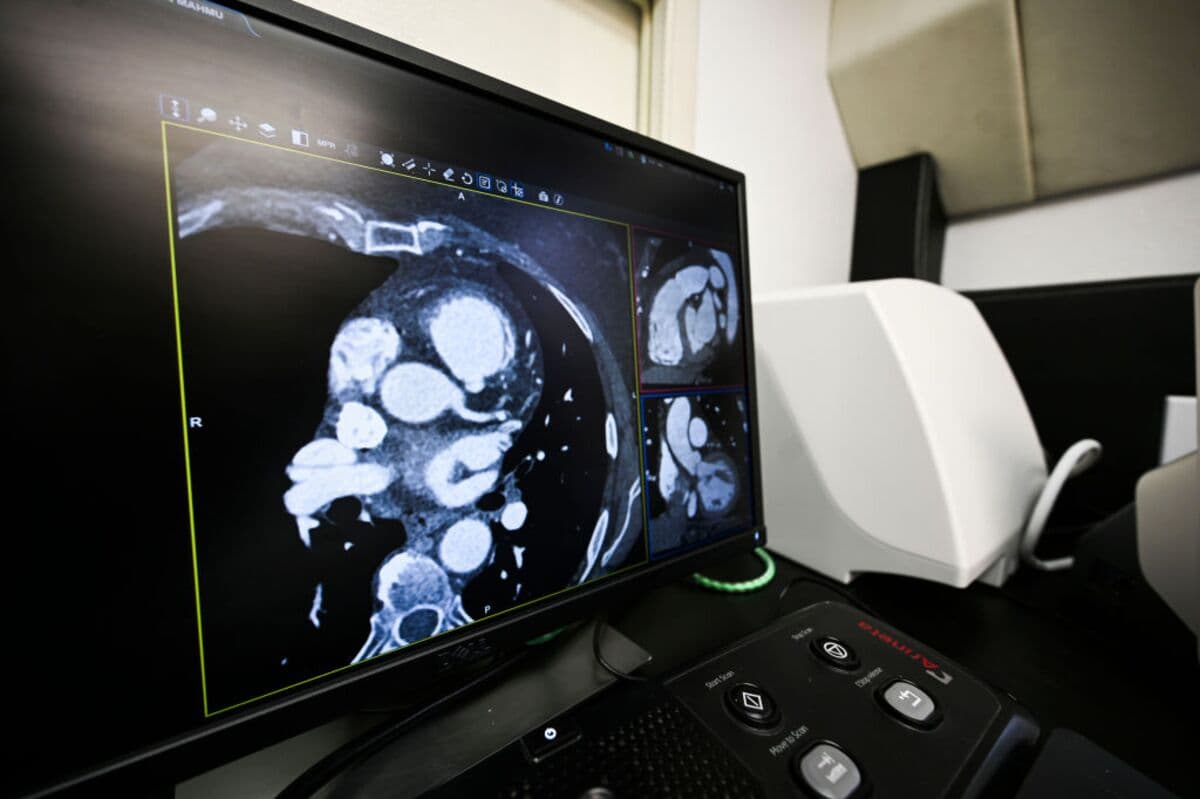 Kardigan Inc. Aims to Raise $373.3 Million in US IPO for Heart Health Drugs
