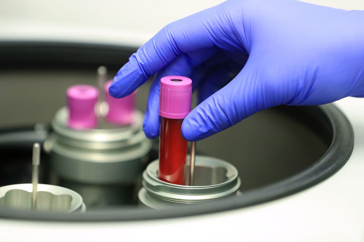 Novo-Backed Biotech Hemab Raises $301.5 Million in Upsized IPO
