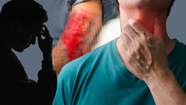 Basit bir boğaz ağrısı kâbusu başlattı: ‘Hayatta olmam bir mucize’ | 25 ameliyat geçirdi... Bu belirtilere dikkat!