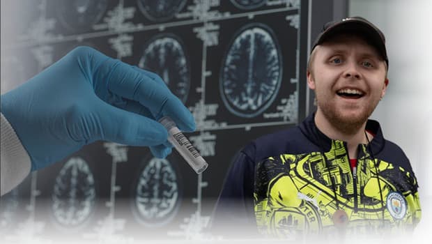 Demansı 'yaşlılık hastalığı' olarak bilirdik… 24 yaşındaki genci nasıl hayattan kopardı?