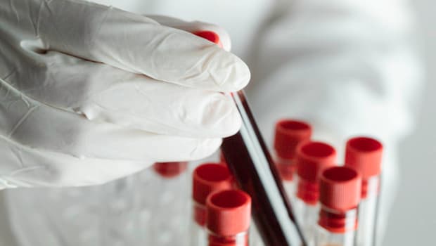 ‘Gençlik’ bu proteinlerde saklı olabilir... 100 yaşına ulaşmanın sırrı kanımızda mı?