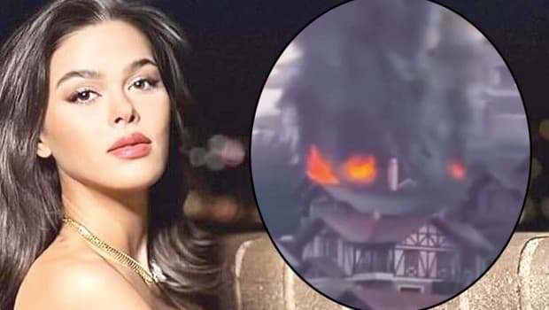 Evinde yangın çıktı, ölümden döndü