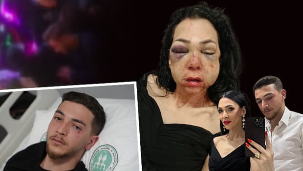 'Kadınlar var' diye uyarılınca dehşet saçtılar! Anne ve oğluna feci dayak... 'Çocuğumun gözü önünde bana bunu yaptılar'