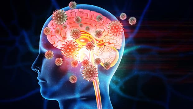 Dünya alarmda! En riskli grup bebekler ve gençler... Menenjit salgını mı var?