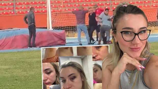 Elif öğretmen eski eşinden şiddet gördüğünü açıkladı, ağabeyi intikam aldı