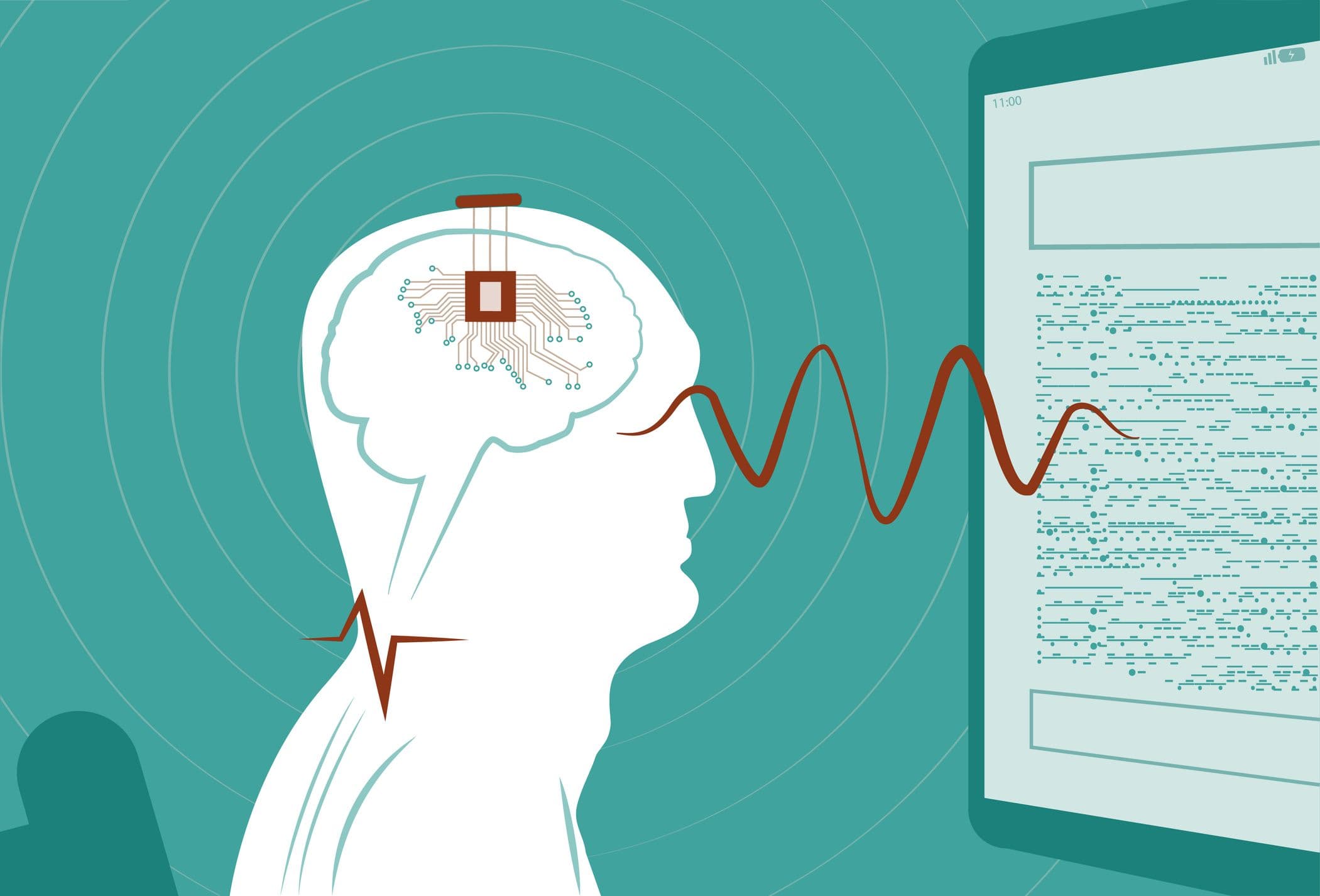 China Approves the First Brain Chips for Sale—and Has a Plan to Dominate the Industry