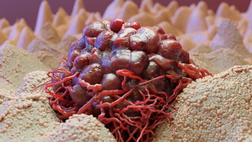 Kronik Stres, Kanserin “Görünmez” Biyolojik Tetikleyicisi Olabilir mi?