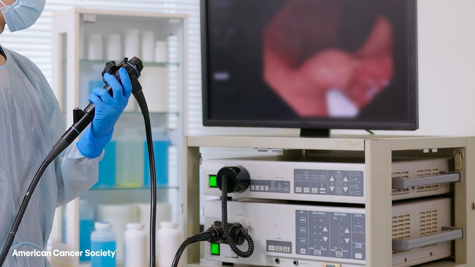 Kolorektal Kanser Vakaları Genç Yetişkinlerde Neden Artış Gösteriyor?