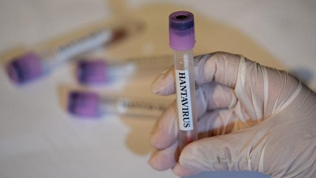 DSÖ, ülkeleri hantavirüs vakalarına karşı uyardı