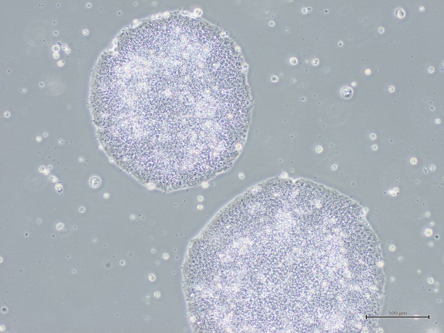 Health Panel Approves First iPS Cell-Derived Treatment for Parkinson’s Disease