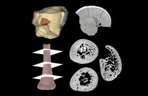 Neandertallerin Ana Rahminde Gelişimi Nasıl Oluyordu?
