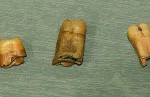 Neandertal Çocuğa Ait Sanılan Dişler Homo Sapiens'e Ait Çıktı