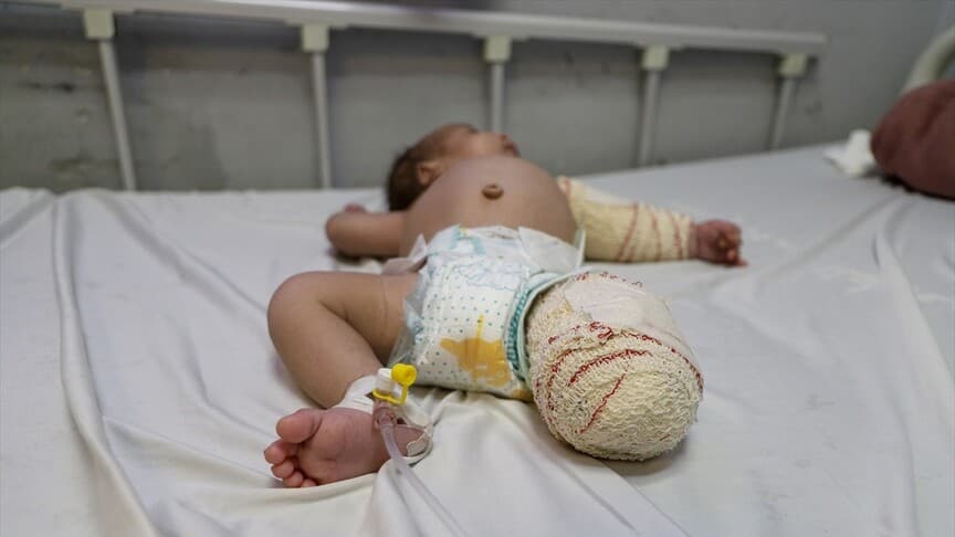 Gazze'de vurulan 50 günlük Muhammed bebek, yaşam mücadelesi veriyor