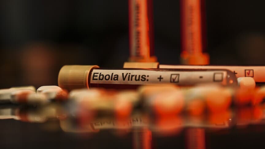 Uganda'da 19 Ebola vakası tespit edildi