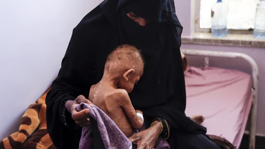 BM, Yemen'de 18 milyondan fazla insanın açlık çektiğini açıkladı