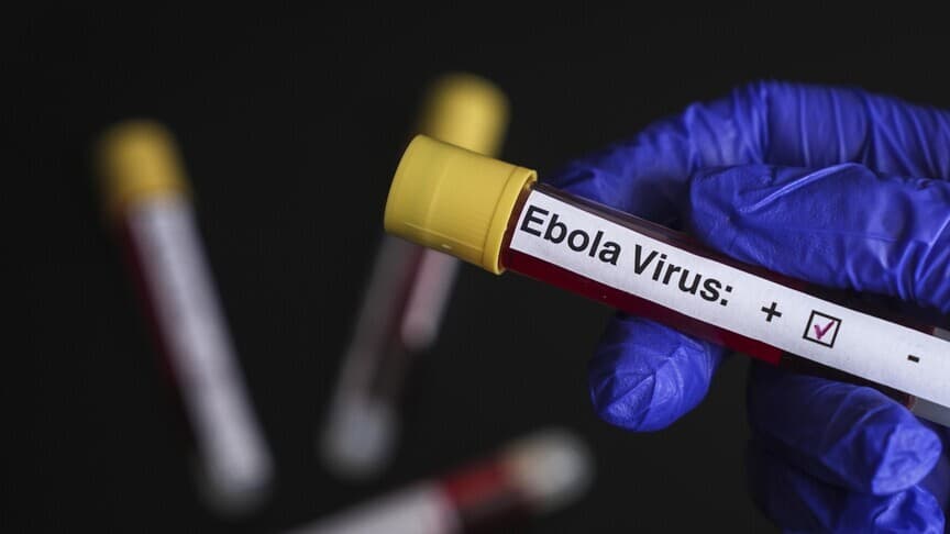 DSÖ: KDC'deki Ebola salgını ciddi durumunu koruyor