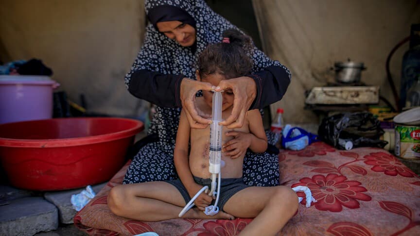 Gazzeli 4 yaşındaki Necva, tedavi için yurt dışına tahliye edilmeyi bekliyor