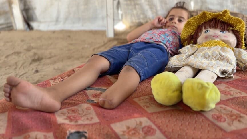 İsrail saldırısında bacağını kaybeden Filistinli kız, eski fotoğraflarına bakıyor