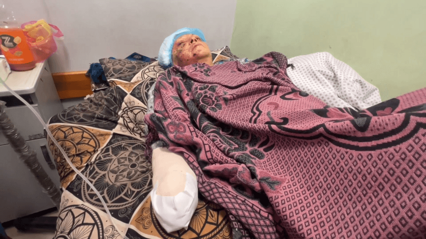 Gazze'de 70 yaşındaki kadın, saldırıda elini kaybetti