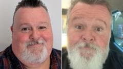 Men's Reluctance to Discuss Use of Weight-Loss Injections