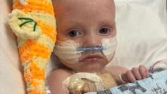 Infant Initially Given Days to Live Thrives After Heart Surgery