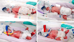 Australia Welcomes Rare Birth of Identical Quadruplets