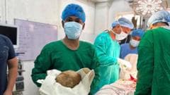 Surgeons Extract 3.1kg Bladder Stone, Potentially Setting a New Record