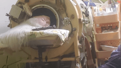 Sister of Last US Polio Patient in Iron Lung Reflects on Her Life and Resilience