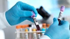 England poised to be among the first nations to eradicate hepatitis C