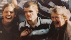 Report reveals that over half of adults with learning disabilities do not reach age 65