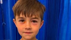 Four-Year-Old Hospitalized After Shein Squishy Toy Explodes
