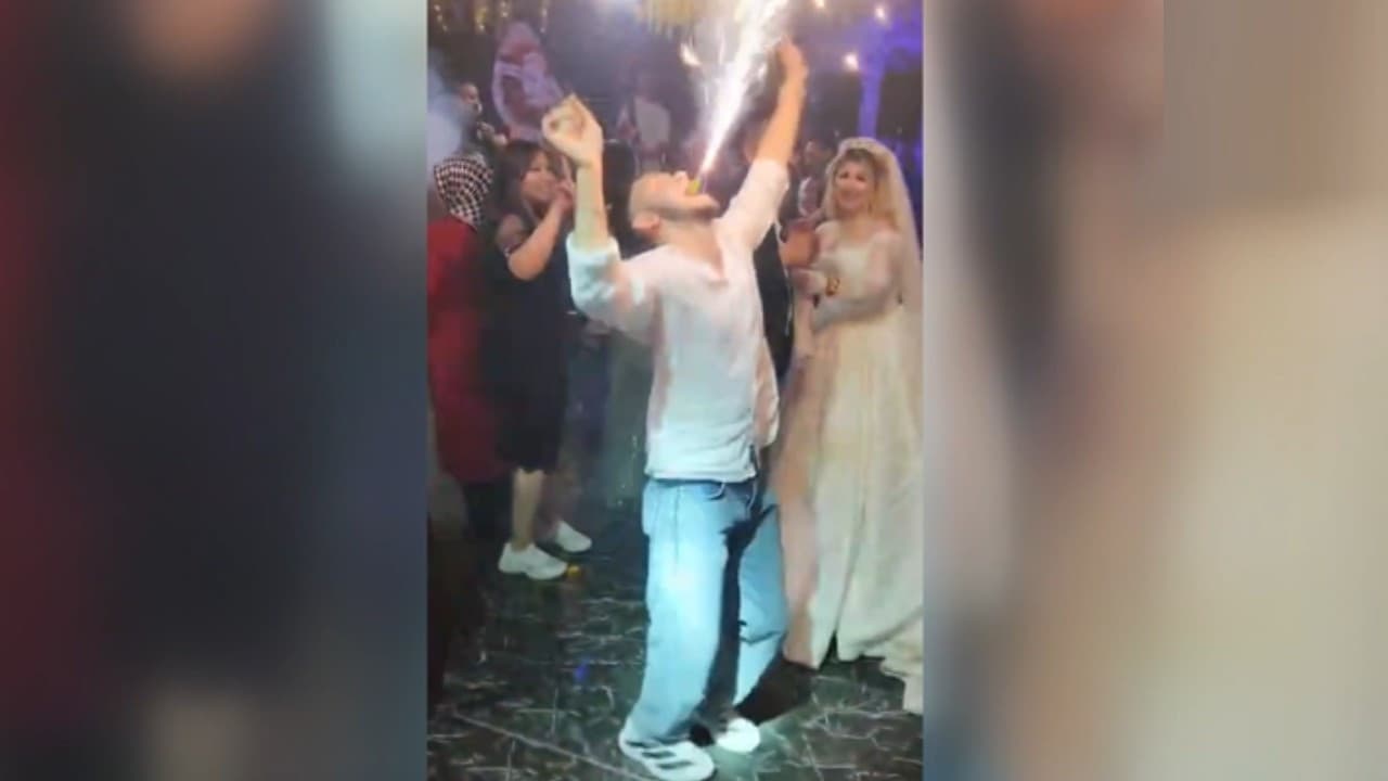 Düğünde meşale patladı, genç yaralandı