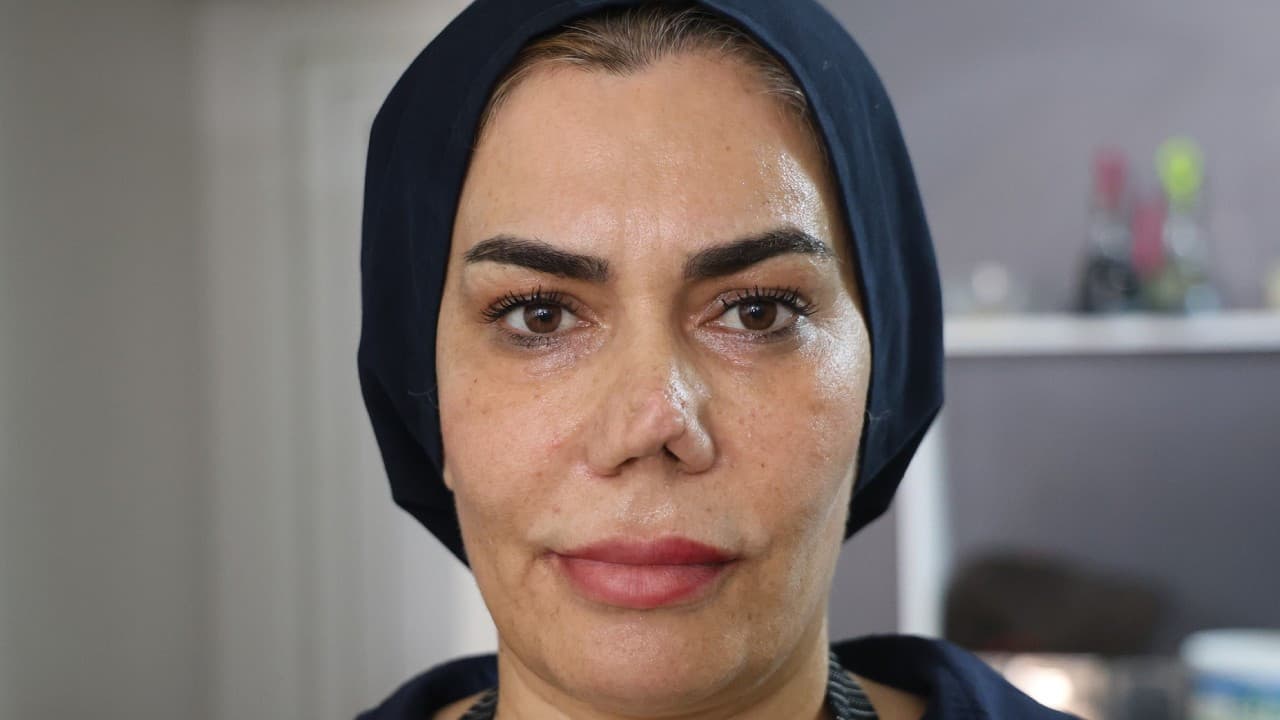 Aysun Alpsoy, burnundaki şekil bozukluğu nedeniyle şikayetçi oldu