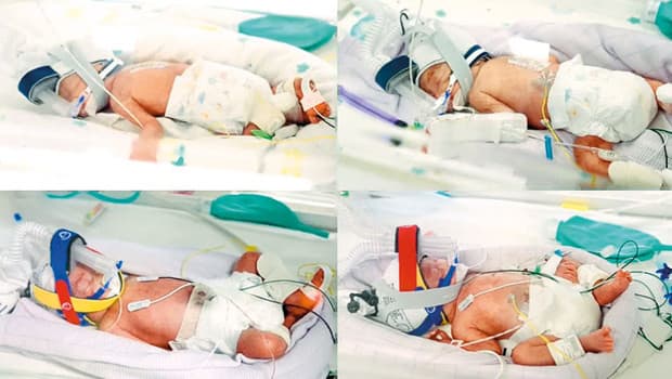 Avustralya'da nadir görülen tek yumurta dördüzleri dünyaya geldi