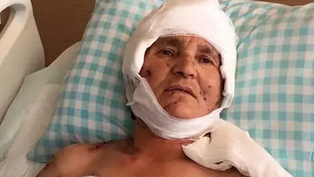 Yargıtay, köpek saldırısında malul kalan kadına 637 bin lira tazminat ödenecek