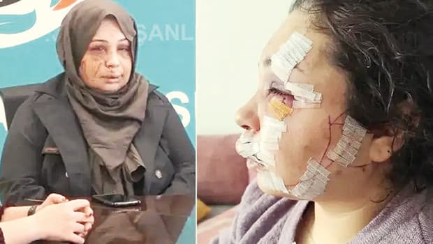 Polis memuruna eşine saldırıdan ceza indirimi