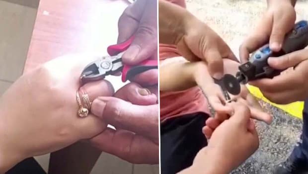 Hatay'da itfaiye, parmağına yüzük sıkışan 3 kişiye yardım etti