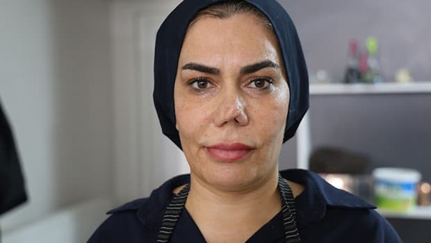 Kırılan burnu için 4 ameliyat geçiren kadın, doktoruna dava açtı