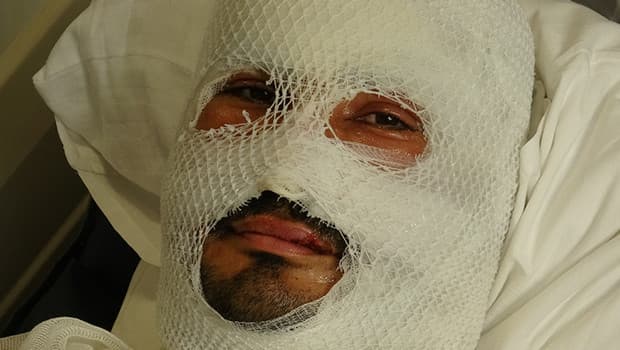 Hatay'da yangında ailesini kurtarmaya çalışan adam yanıklarla hastaneye kaldırıldı