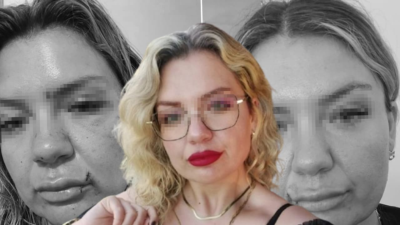 Antalya'da eski erkek arkadaşının bıçaklı saldırısına uğrayan kadın hastaneye kaldırıldı