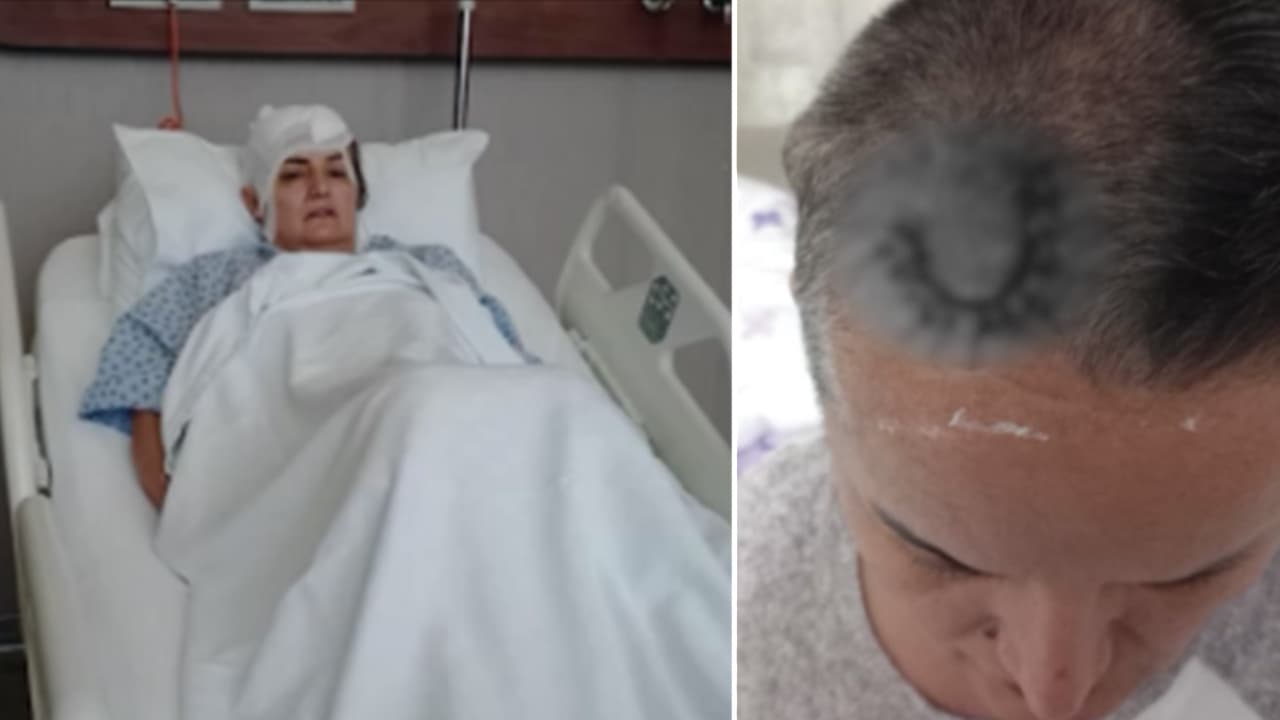Diş tedavisi sonrası hayatı değişti: Ömür boyu cihaz takıldı