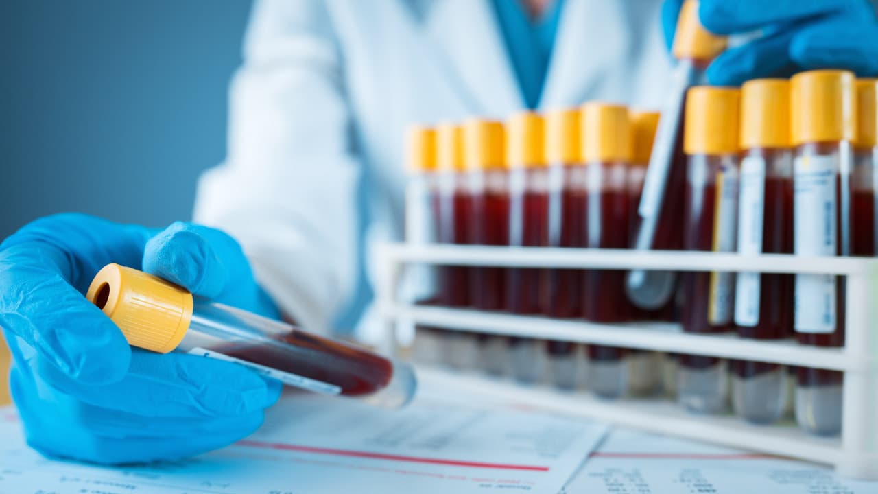 FDA, kolon kanseri taraması için yeni kan testini onayladı