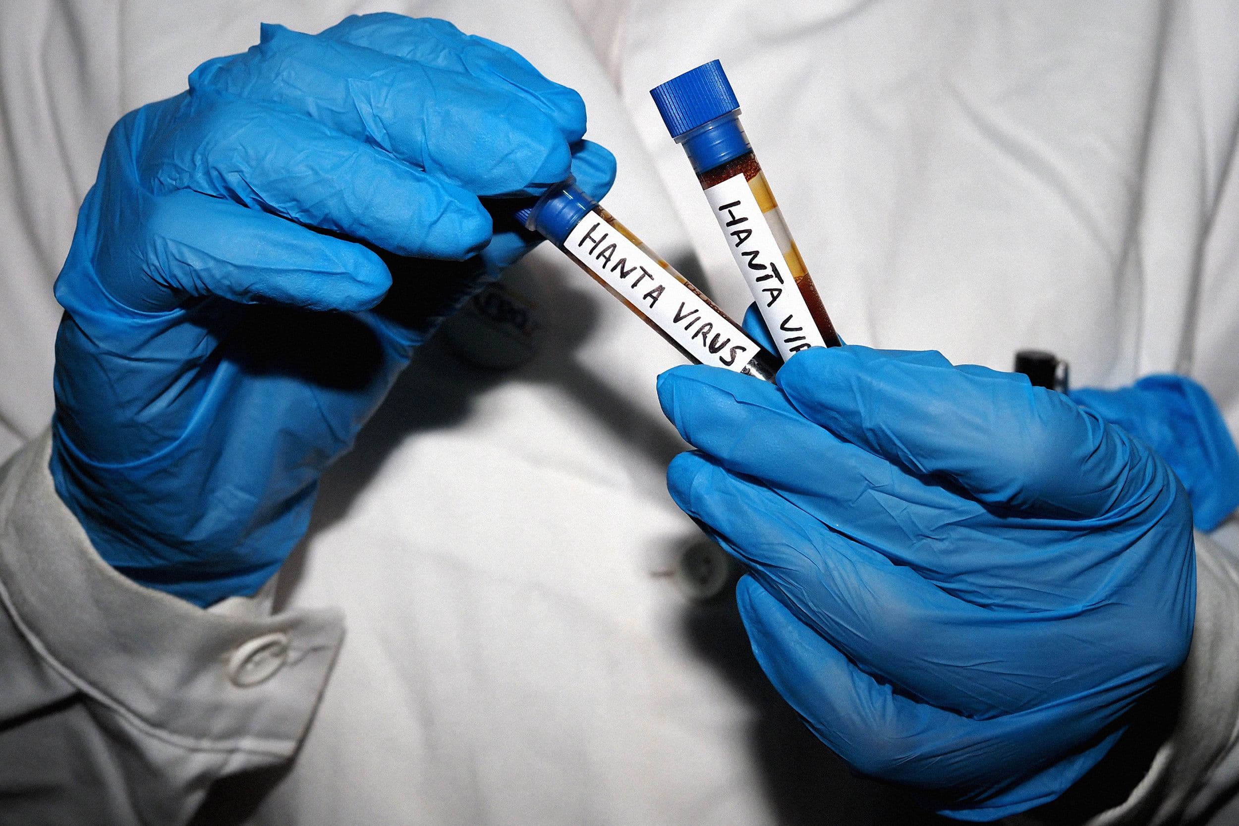 Expert Addresses Common Questions About Hantavirus and Its Risks