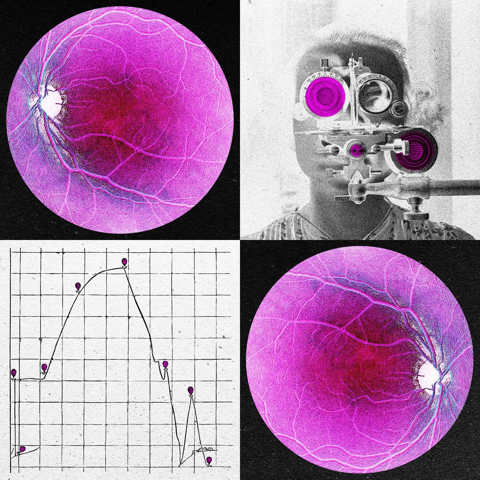 Longevity Startup Begins Human Trials for Age-Related Vision Loss Treatment