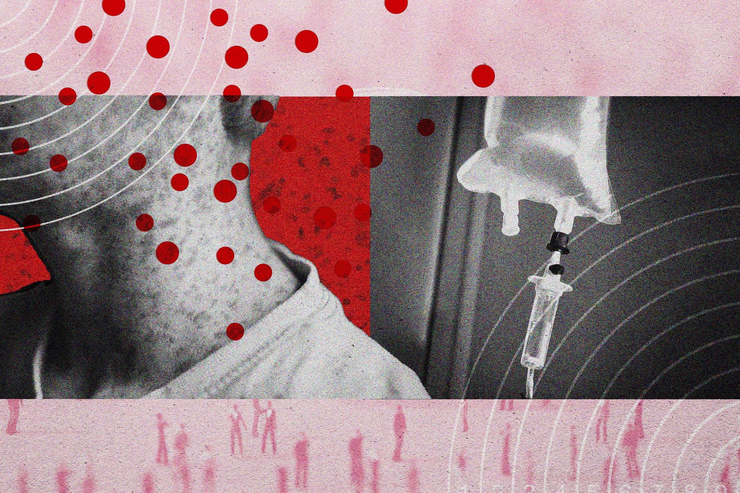 Rising Measles Cases Prompt Development of New Treatments